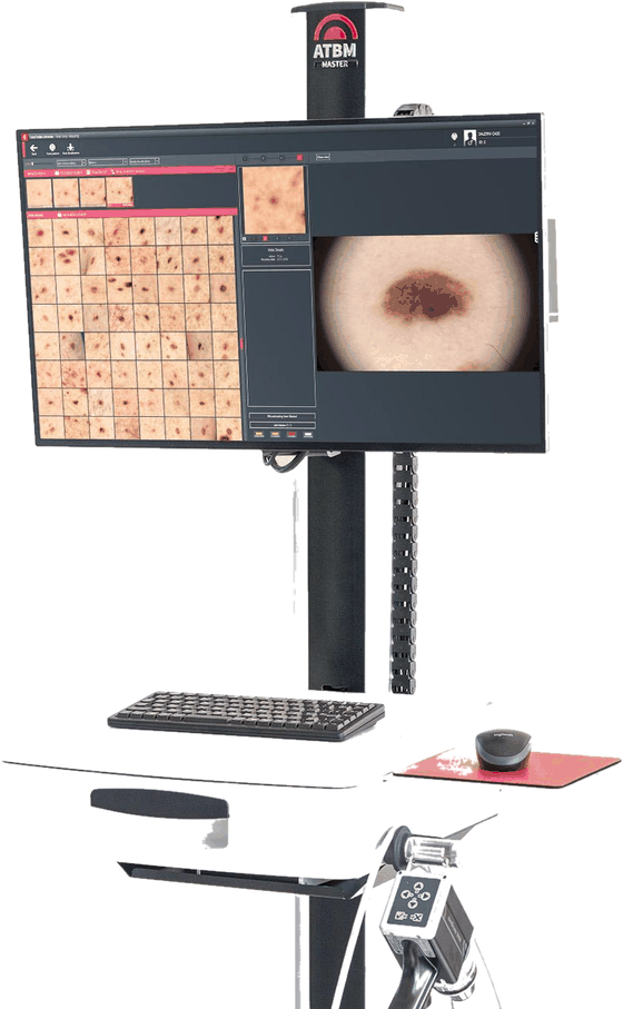 Equipamento FotoFinder ATBM Master